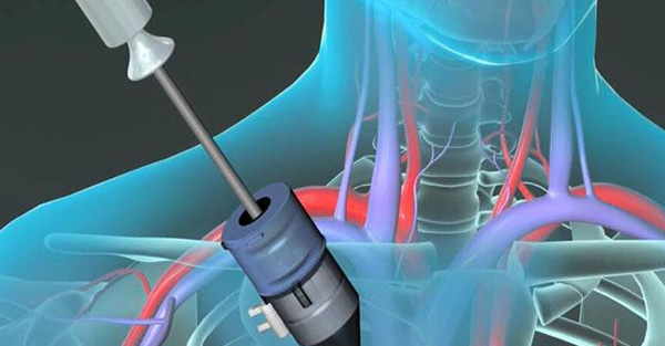 �Ϸ����S��(d��ng)������